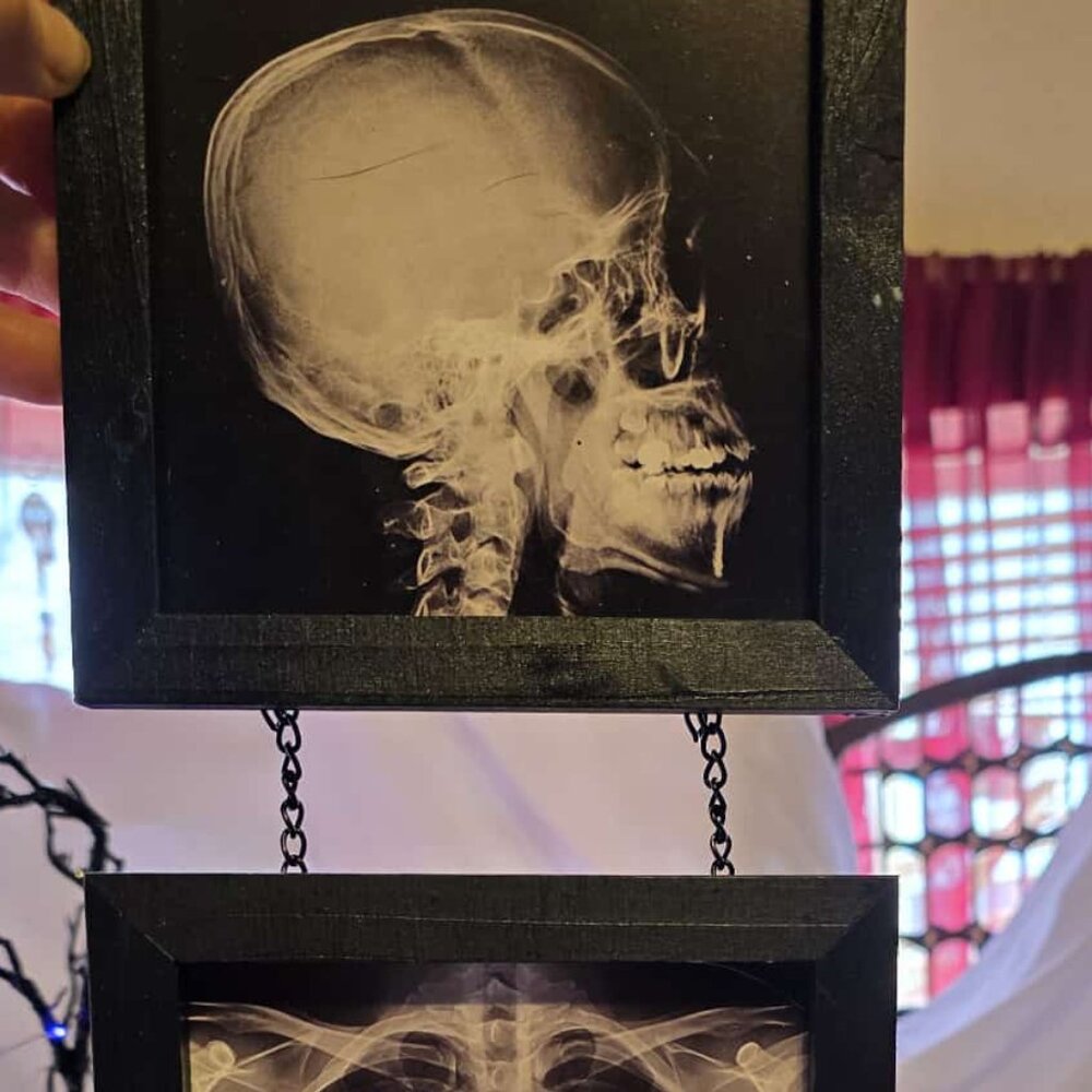 Gothic Medical X-Ray Art - Framed Anatomical Decor Set